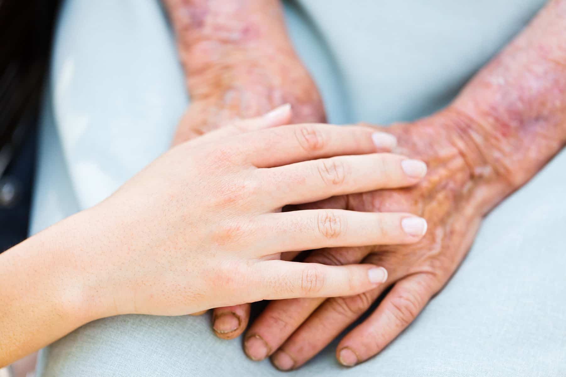 Malnourishment: The Surprising Demographic That's At High Risk